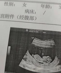 �ɿ������ף�36�������̥�������ռǡ�