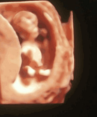 ��Ϊ�����ֻ���˱���һ��ͱ���ȥ���ƣ���ô������Ԥ�������