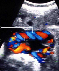 ������ڳ�����鹥�ԣ������������������