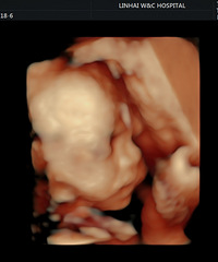 ��Ƥţţ����������1+1=4��+��2022�����ռǡ�