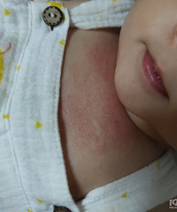 �����ؿ�һƬ�����״���Ǹ���ʪ������ӣ�