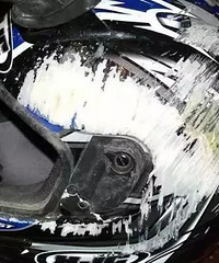 �·�̨�ݣ������Σ�ͷ���ѣ���û�£�