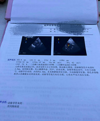 [������]�޶�������δ���ھ�2.4mm�������ȱ��2.8mm