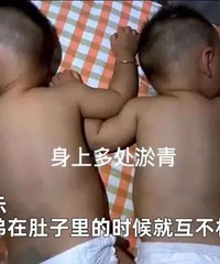 �������ѣ��Ķ���7�ڴΣ�˫��̥���д�ܣ�������������ࣿ