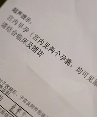 �Թ�˫̥��̥���մ���