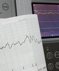 ��ͼʾ����̥�ļ໤����Ѫ����ⱨ�浥���ְ��ֽ�����ٶ���