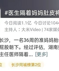 1���ӣ�ҽ������׼�����Ƥ���������˸�ͷ