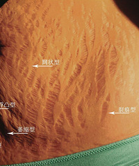 ���������Ƶ��ٴ����֣��ɴ�ŷ�Ϊ����6�����ͣ��������֣�