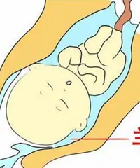 ����̥���ò��ã���ˮָ��ܹؼ�