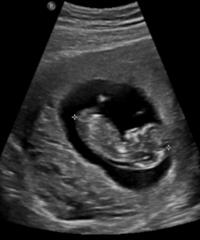 [�����ռ�]������޼ƻ�һ�������޵ľ���