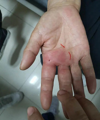 注意这种鱼!有毒!