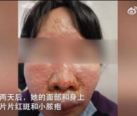 Ů�Ӹ�Ⱦ�¹ں��ҳ�ҩ��ȫ�����ƽ���ICU��