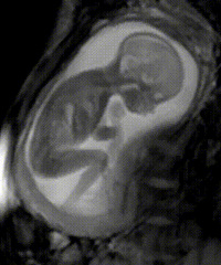 ҽ���ж�̥����û�����裬���ǿ�������ơ���