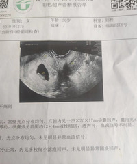 老婆怀孕后,医生第一句差点惊掉下巴:要吗?我说当然要