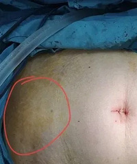 ������������Ҫע�⣡�������ʹ��Ů�ԣ������շ�������