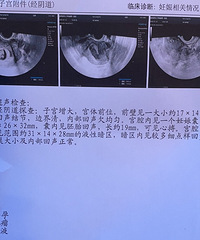 ��̬��������Բ��ϵı仯+��2023�����ռǡ�