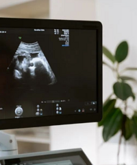 ����ؿ������Ż���С�Ż���ʲô����