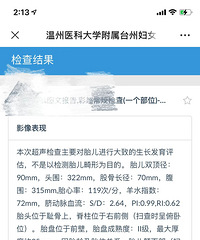 �����¼ӷ������˱������������룬����10ָ����