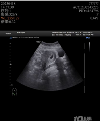 һ���Բۣ����ֻ����ˡ�2023�����ռǡ�