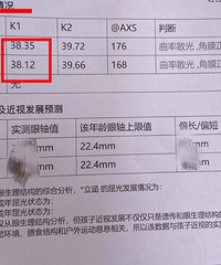 ����С�����۾����⣬�ҵĽ�ѵ�����