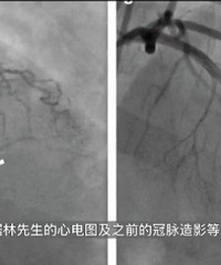 ���Ӳ�д��ҵ�ְ�������ҽ���� ԭ���ְ�Ҳ�ᱻ��������...