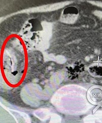 ����ϰ�ߣ�Ů��С�����ظ�Ⱦ�����������˹����š��ܶ���ȴ������