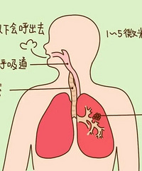 ���ᣡ�Ƿ�Ҫ���1000Ԫ����������ȥҽԺ��̫�鷳��