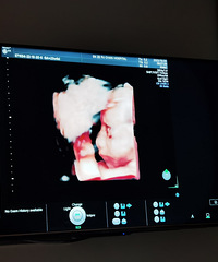 [2024�����ռ�]��ҹ���޵�һ��