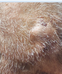 ������ͷײ�������ϣ�����һ���������ʲôҩ��