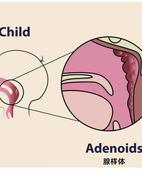 Ϊʲô���ڻ�������ʴ�ĺ���Խ��Խ��?