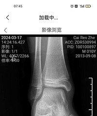 [ר������]�޽ź��ʹ�˿������զ�죿