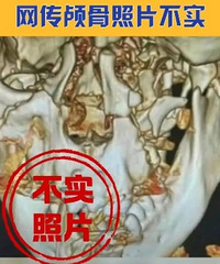 ��13���һ������ɱ�������ٷ�ͨ����ȫ��ץ������ȫ��������