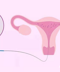 ����Ů���þ��ӿ⡰ȥ�����ӡ�����Ӧ����