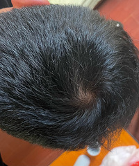 87�������������δ���������򵥼ҳ��ˣ�ϣ���ܹ��������ʵ���