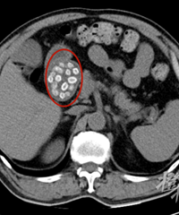 �������飬�󲮸���ȡ����60����÷�ˣ��ֵ���������ĸ߷���