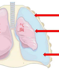 �̶�1���£�̨��11��ѧ���Ρ������ˣ�ҽ�����ѣ������˼�����