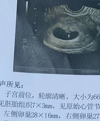 �ڴ��ҵ�������+��2024�����ռǡ���