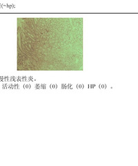 θ�����ĸо���������п־�֢��