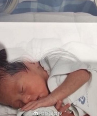 ��������Ů�������İ�̥�����飬ҽ������̥����ԭ���Ͻ����̥