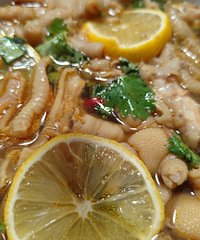 ���޹Ǽ�צ��17����צ�ѹǾͻ���2��Сʱ