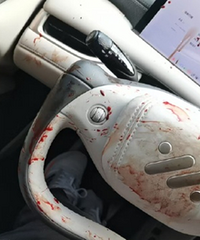 ����ĸ���롰���š�Ĩ��һ����Ѫ