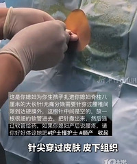 ҽ����Ա����Ů�Է����õ���ʹ�룬�����8����