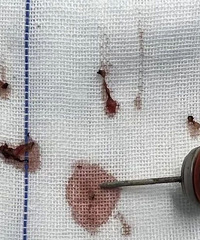 2�꺢��һ��ҧ�£�˲�䱬ը������Ѫ��ģ���������˼��ﶼ��