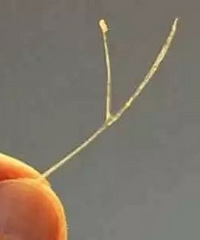 ���ģ�һ����̣�̨��Ů��ʹ����5���£�ҽ�����ѡ�