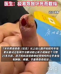 7���к�ҧ��ָ�����Ⱦ�����ף�ҽ�������׵�����ָ��������ָ