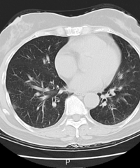 ���ԣ�һ��6�ڳ��Σ�5�˸�Ⱦ���������ѡ�