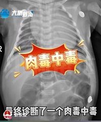 52��Ӥ��������ι�ķ���ˮ�ж���icu