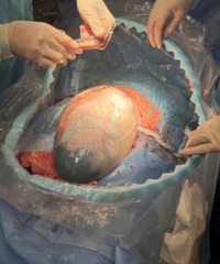 զ���£�̨�����边��������ʵ�桰˫��̥��߸����