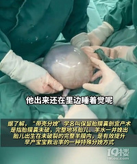 ҽ���Ӳ����Ǳ������ھ�ϲ