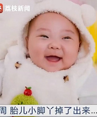 ���գ�����21��ʱ̥��С��Ѿ���˳���